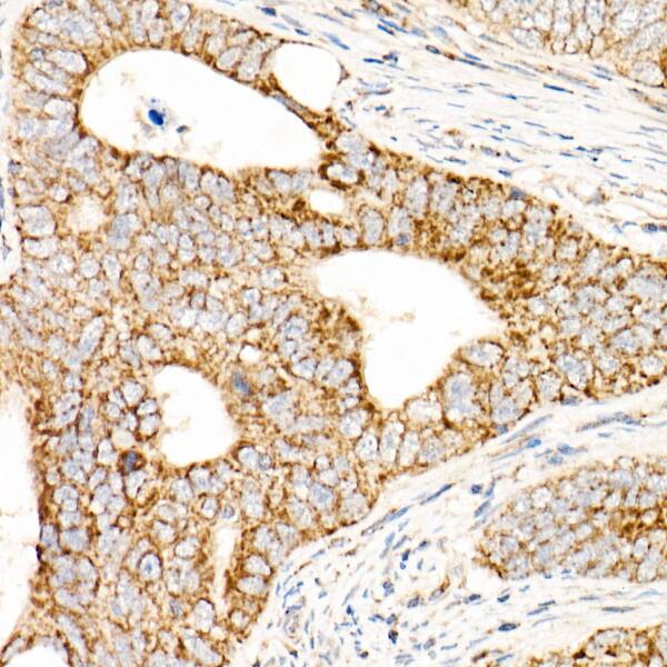 AFG3L2 Antibody