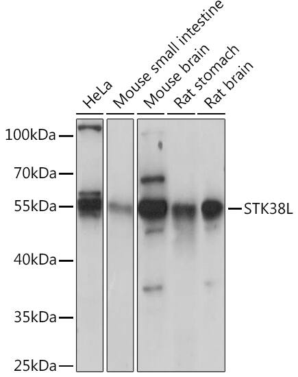 STK38L Antibody