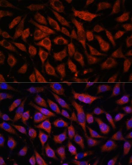 STK38L Antibody
