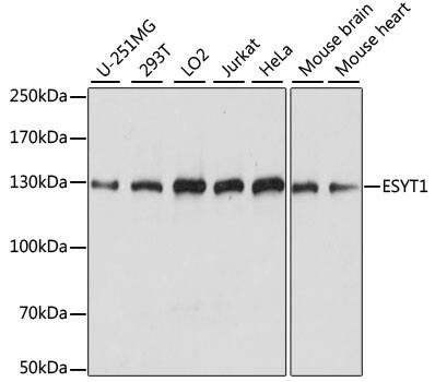 FAM62A Antibody