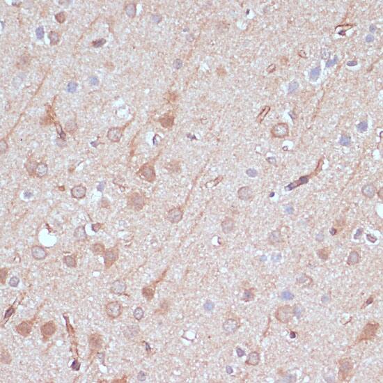 AK5 Antibody