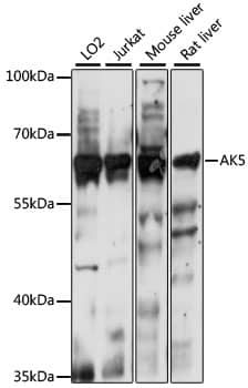 AK5 Antibody