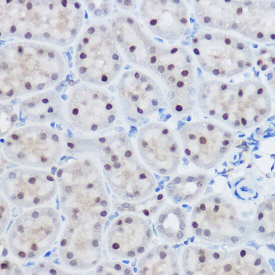 Apc11 Antibody