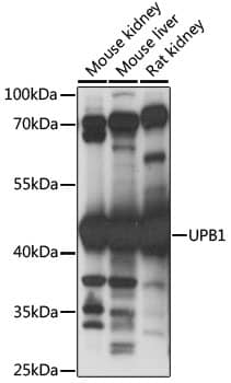 beta ureidopropionase Antibody