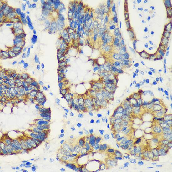 USP47 Antibody