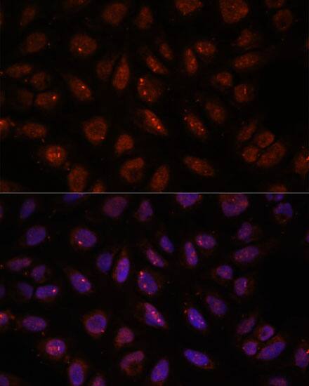 DDX24 Antibody