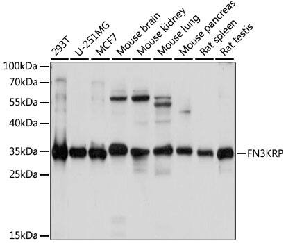 Fructosamine-3-kinase-related Antibody