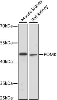 POMK/SGK196 Antibody