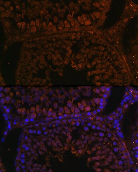 TPD52L3/D55 Antibody