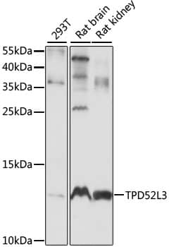 TPD52L3/D55 Antibody