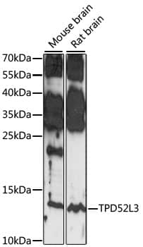 TPD52L3/D55 Antibody