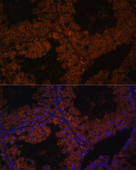 TPD52L3/D55 Antibody