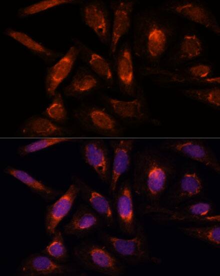 mtRNA polymerase Antibody