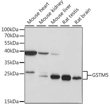 Glutathione S-transferase Mu 5 Antibody