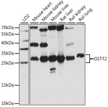 GSTT2 Antibody