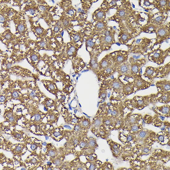 Monoamine Oxidase B Antibody