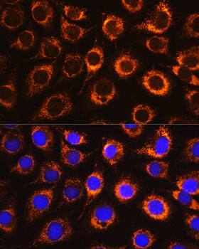 Monoamine Oxidase B Antibody