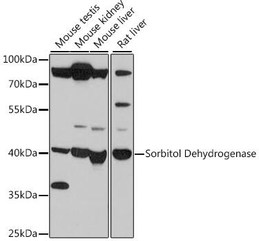 Sorbitol Dehydrogenase Antibody