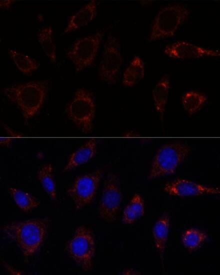 TBRG4 Antibody