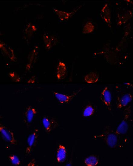 TBRG4 Antibody