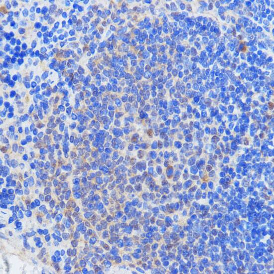 HCC1 Antibody