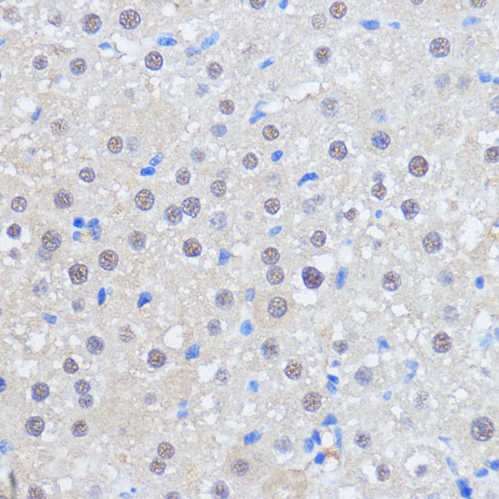 HCC1 Antibody