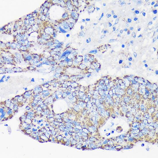 ACAA2 Antibody