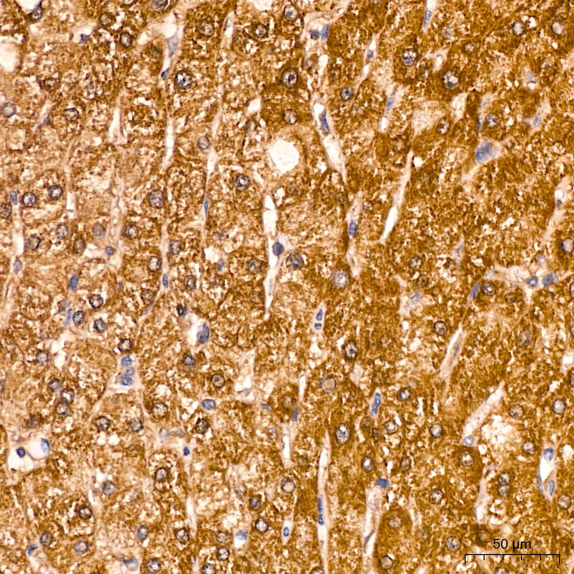 ACAA2 Antibody