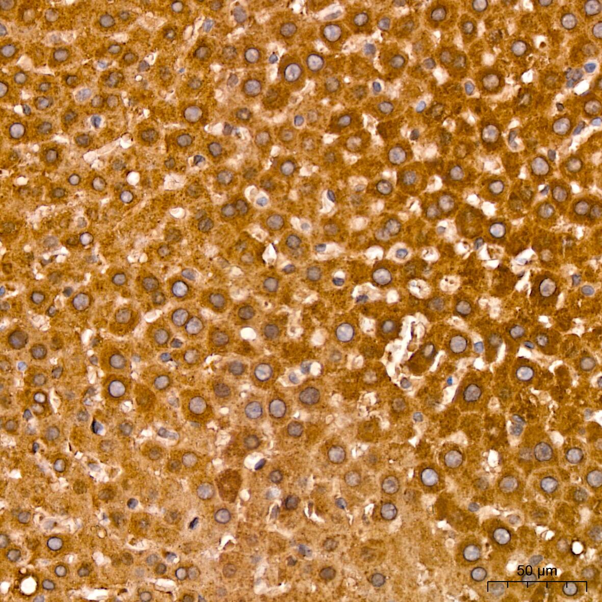 ACAA2 Antibody