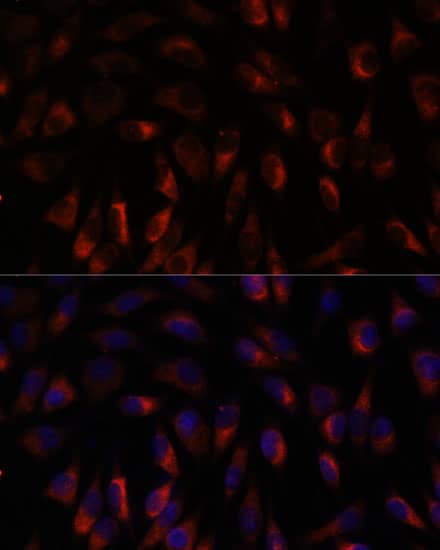 Calcium-binding-protein-P22 Antibody