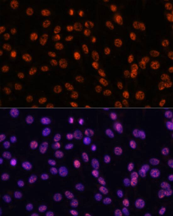 SAP155 Antibody