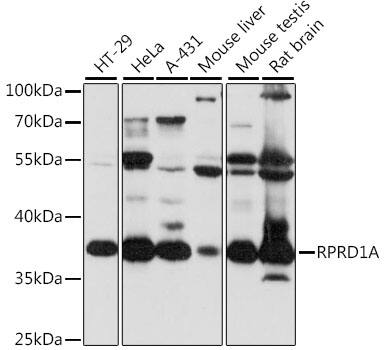 P15RS Antibody