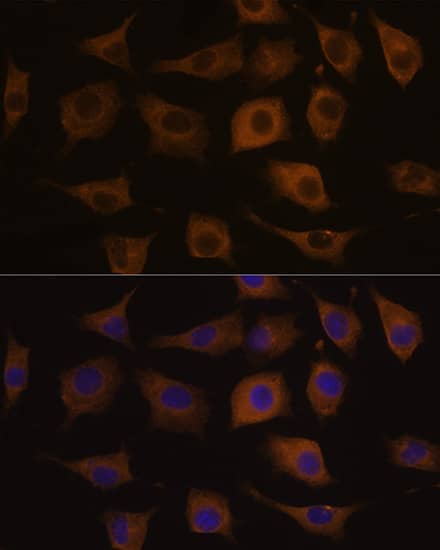 Nicotinic Acetylcholine R alpha 7/CHRNA7 Antibody