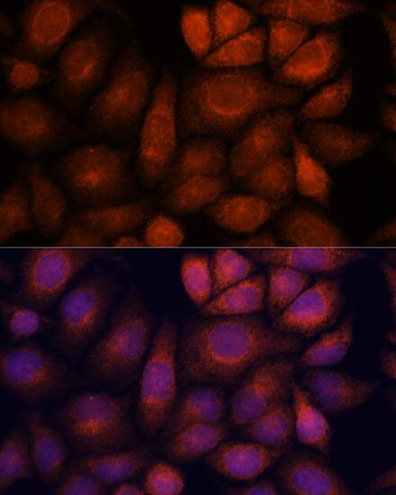 KIF13A Antibody