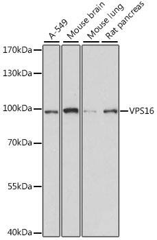 VPS16 Antibody