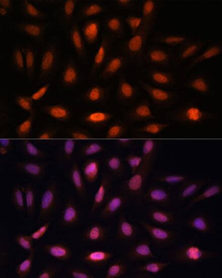 PPIL4 Antibody