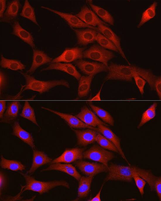 TRIM4 Antibody