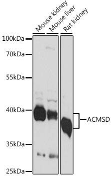 ACMSD Antibody