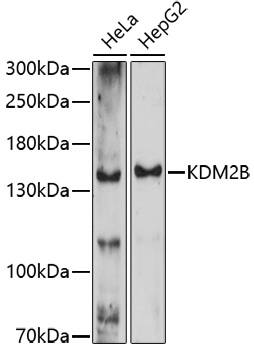 KDM2B Antibody