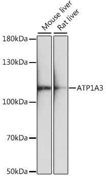 Sodium Potassium ATPase Alpha 3 Antibody