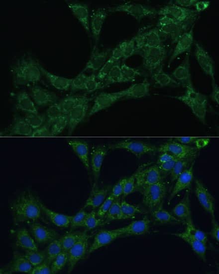 ETFB Antibody