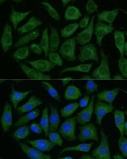 GRF2 Antibody