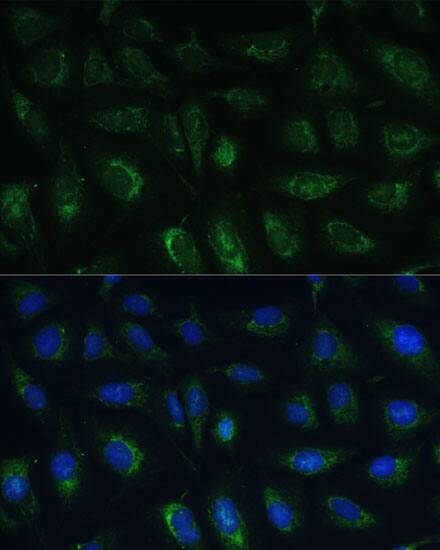 GRF2 Antibody