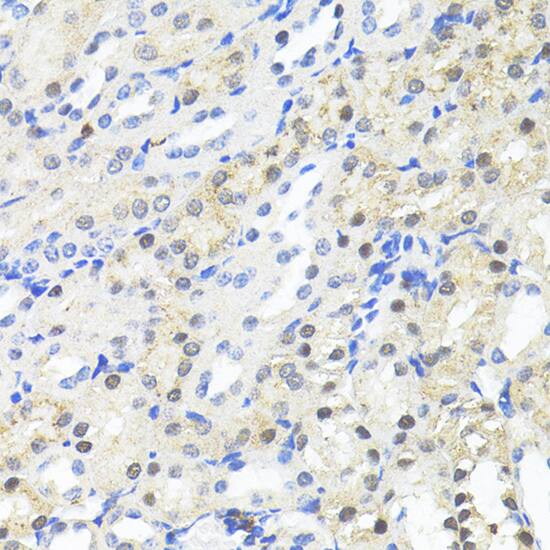 TRIM27 Antibody