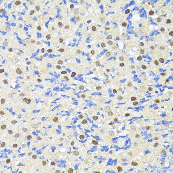 TRIM27 Antibody