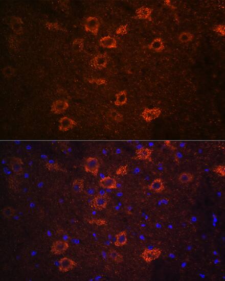 VAChT/SLC18A3 Antibody