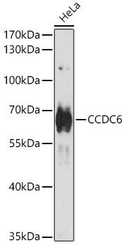 CCDC6 Antibody