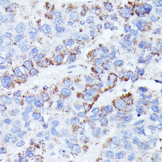 CCDC6 Antibody