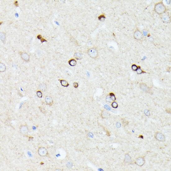 CCDC6 Antibody