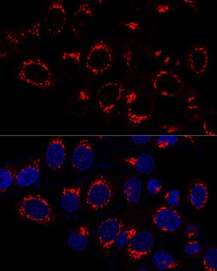 VDP p115 Antibody